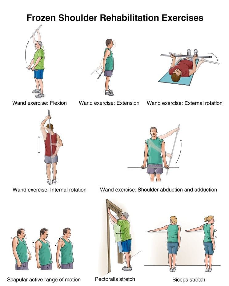 Frozen Shoulder Treatment and Rehabilitation Exercises