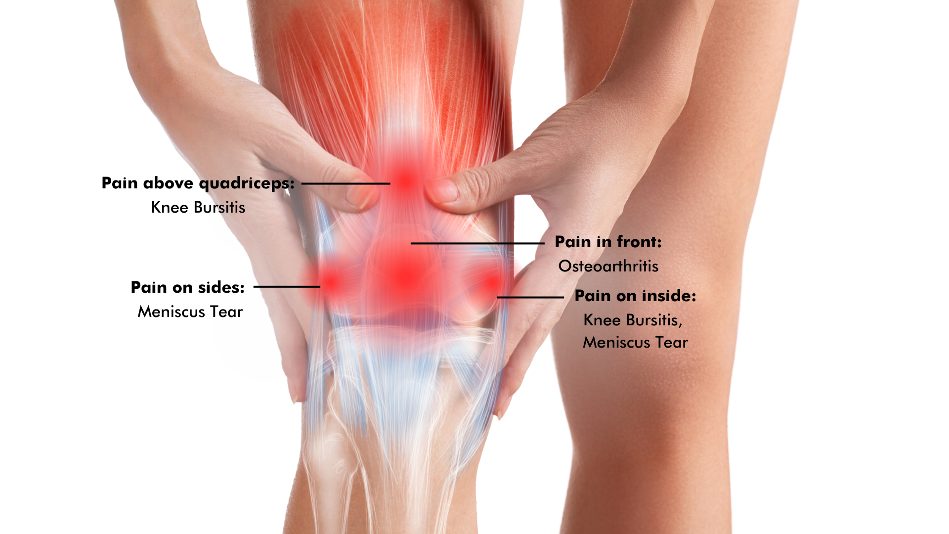 Knee Instability Treatment by Dr. Jigar Desai